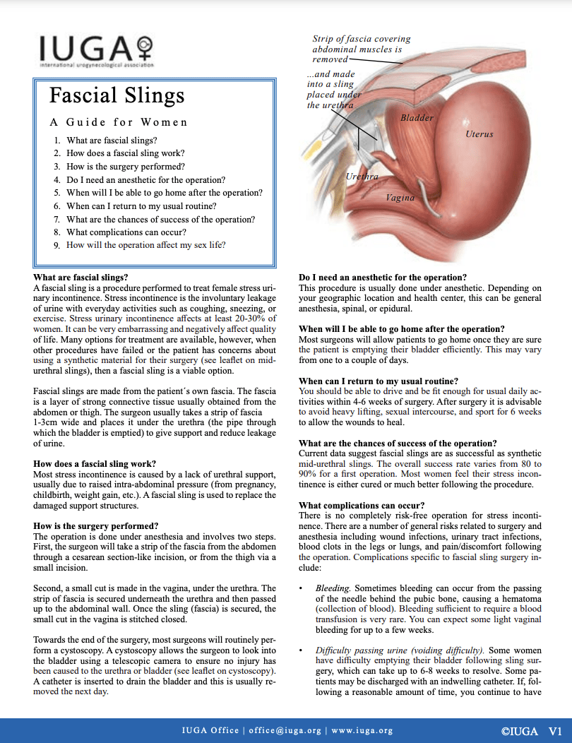 Fascial slings
