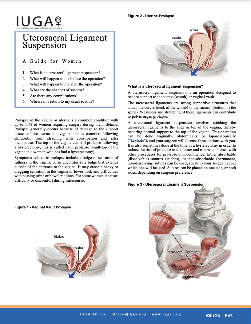 uterosacral ligament suspension